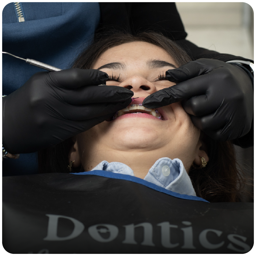 Ortodoncia estética